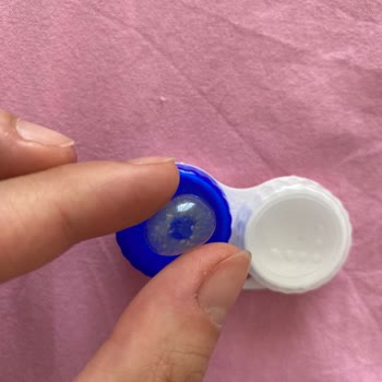 Dimgray Lenslerde Şişme Sorunu Ve Yetersiz Müşteri Çözümü