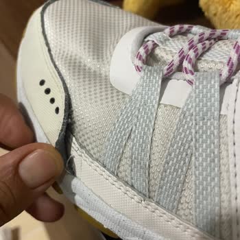 Skechers Ayakkabım Kısa Sürede Deforme Oldu Değişim Talebi