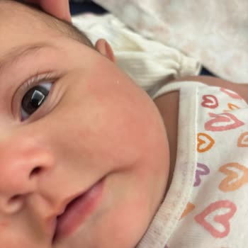 Bebek Şampuanı Cilt Tahrişi Ve İade Talebi