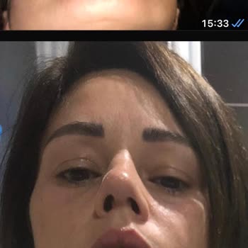 Dr. Arda Pelen Hem Sağlık Hem de Estetik Açıdan Büyük Sıkıntı Yaşadım
