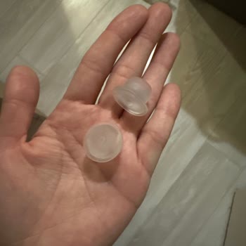Kına Salonunda Patlayan Konfeti Tıpası Gözümde Şişti Ve Yetkililer Cevap Vermedi