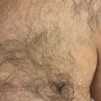 Esse Life Başakşehir Cilt Bakımında Roza ve Lazer Epilasyonda Etkisizlik