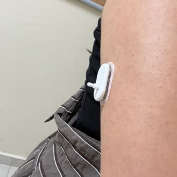 Sibionics GS1 Sensöründe Hatalı Yerleşim, Alarm Çalışmıyor Ve Müşteri Desteği Cevapsız