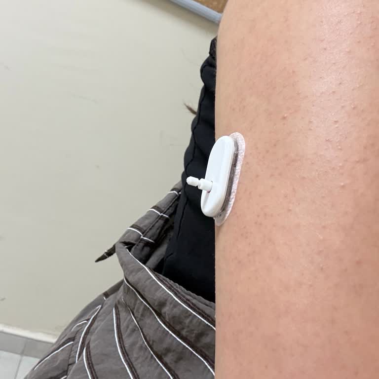 Sibionics GS1 Sensöründe Hatalı Yerleşim, Alarm Çalışmıyor Ve Müşteri Desteği Cevapsız