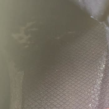 Skechers Ayakkabıda Hafızalı Köpük Deformasyonu Ve Garanti Reddi