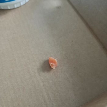Pidem Restaurant Çiğ Tavuk ve Sağlık Riski