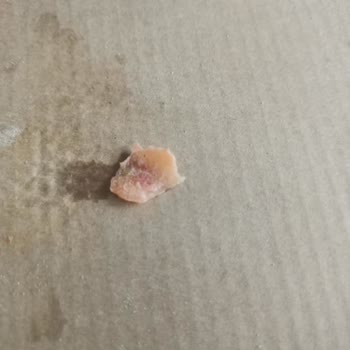 Pidem Restaurant Çiğ Tavuk ve Sağlık Riski