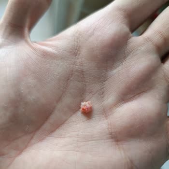 Torku Sucuğunda Kemik Parçası Bulunması