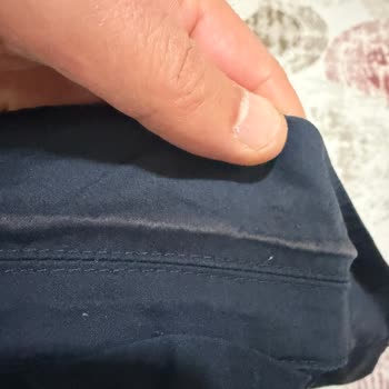 Mango Erkek Ceketi Kısa Sürede Renk Solması Ve Trendyol İade Reddi