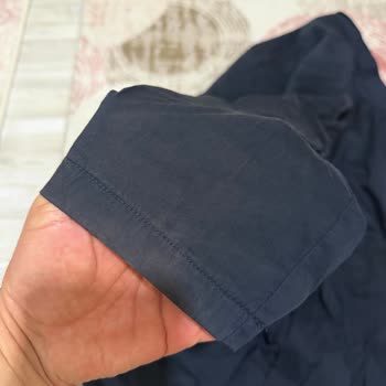 Mango Erkek Ceketi Kısa Sürede Renk Solması Ve Trendyol İade Reddi