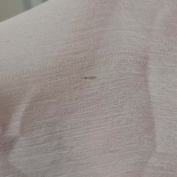 Hazem Rental Dress Giyilmeyecek Halde Elbise Gönderdi