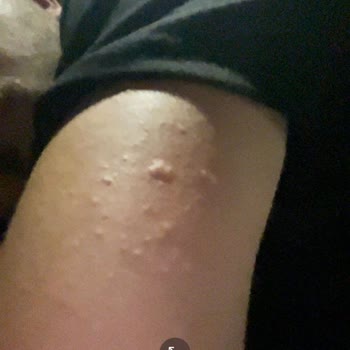 Tatilcikus'un Yanıltıcı Bilgilendirmesi Ve Kıbrıs Otelinde Çalışmayan Temel Hizmetler