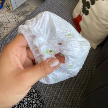 Sleepy Külot Bezlerinde Yırtık Ve Delik, Yarım Ücret Boşa Gitti