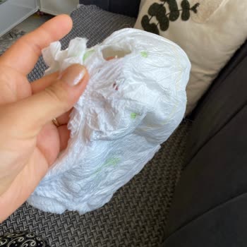 Sleepy Külot Bezlerinde Yırtık Ve Delik, Yarım Ücret Boşa Gitti