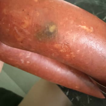 Köfteci Yusuf Küflü Sucuk Ve Eksik Gramajlı Kanat İadesi Talebi