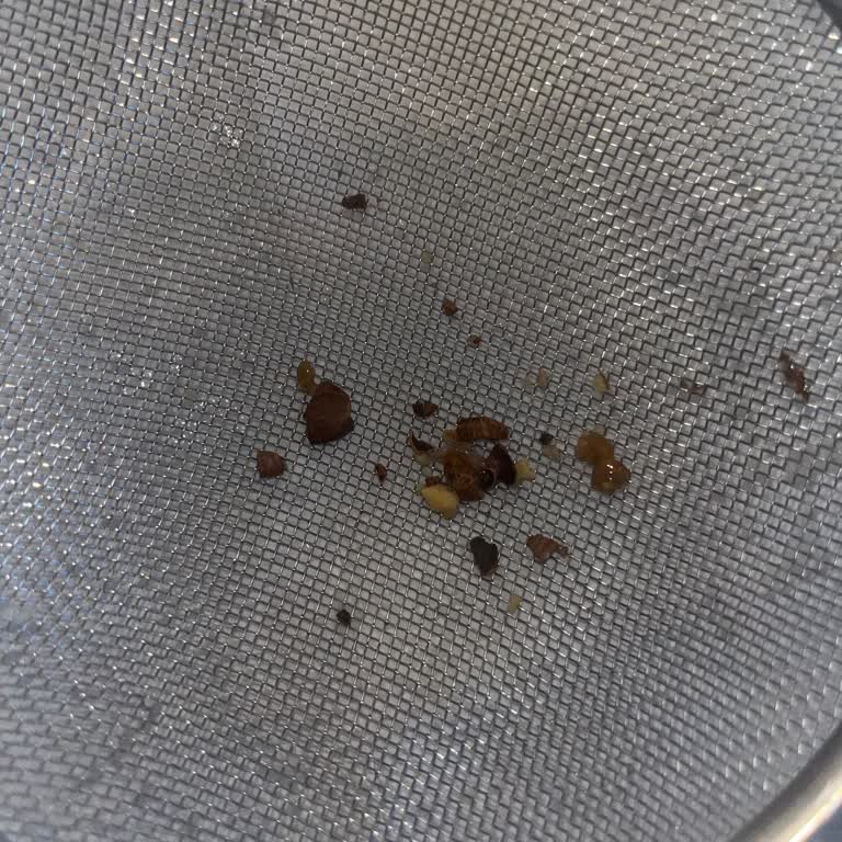 Toffifee Çikolatasında Sert Fındık Parçası Dişimi Zarar Verdi