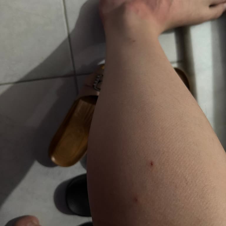 Etstur Sivrisinek Sorunu ve Personel Ayrımcılığı