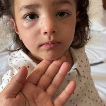 Hijyen Sorunları Ve Sürekli Gürültü Şikayetim