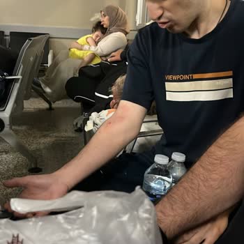 Acil Serviste Yanlış İlaçlı Tomografi Ve Damar Yolu Uygulaması Sonucu Şişme Ve İlgisiz Yaklaşım