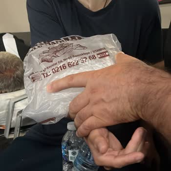 Acil Serviste Yanlış İlaçlı Tomografi Ve Damar Yolu Uygulaması Sonucu Şişme Ve İlgisiz Yaklaşım