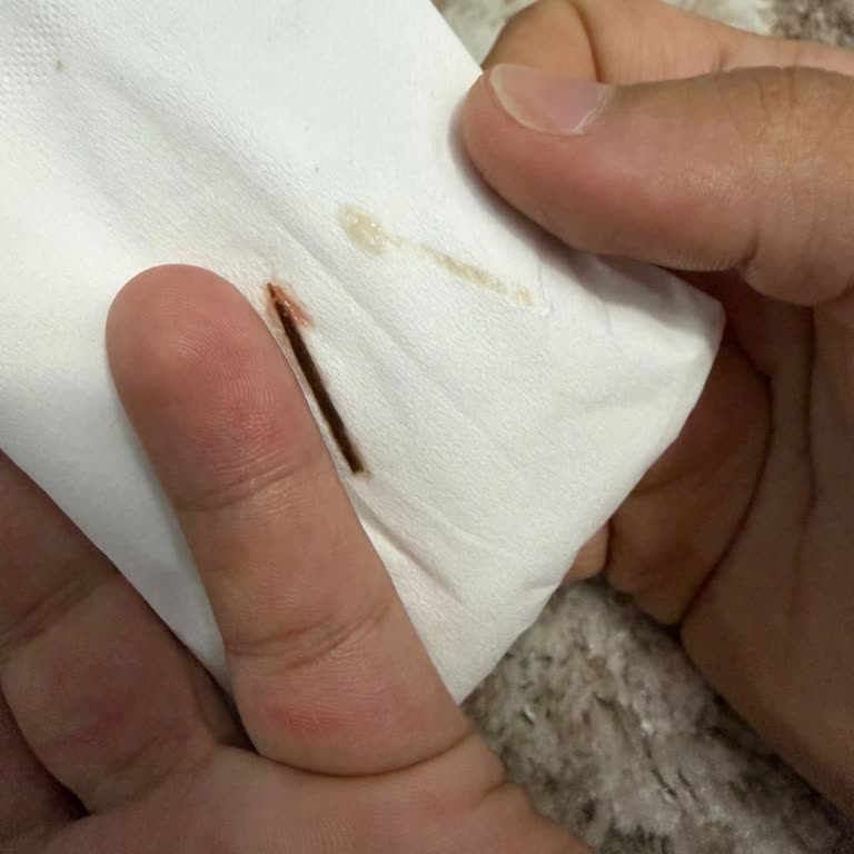 Ameliyat Sonrası Yabancı Parça Kaldırma Hatası Ve Şiddetli Enfeksiyon