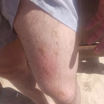 Çamlıköy Tabiat Parkı Ziftli Denize Girmemize Göz Yumdular