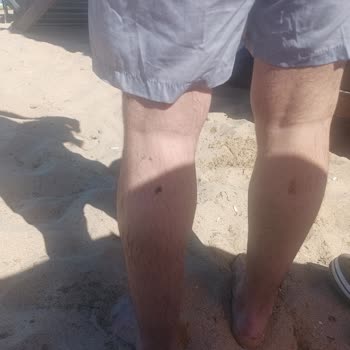 Çamlıköy Tabiat Parkı Ziftli Denize Girmemize Göz Yumdular