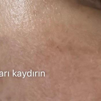 Eki aç