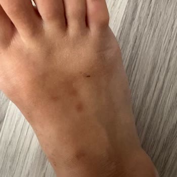 Ayıplı Terlikte Zımbalar Yara Oluşturdu, İade Talep Ediyorum