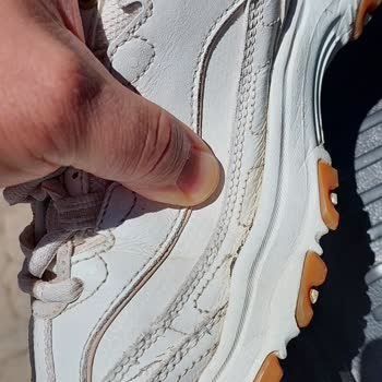 Kısa Sürede Çatlayan Skechers Ayakkabısı İçin İade Talebi Ve Mağazanın Kullanıcı Hatası İddiası