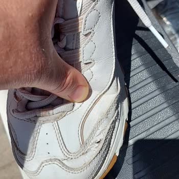 Kısa Sürede Çatlayan Skechers Ayakkabısı İçin İade Talebi Ve Mağazanın Kullanıcı Hatası İddiası