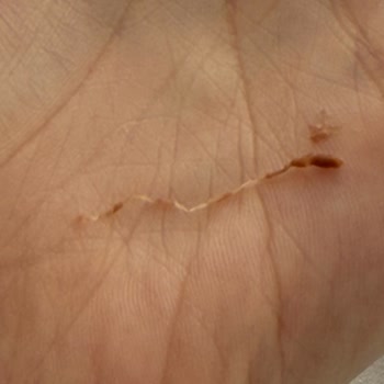 Kavanozun Sonunda Şeffaf İp Parçaları: Gıda Güvenliğine Dair Derin Endişe