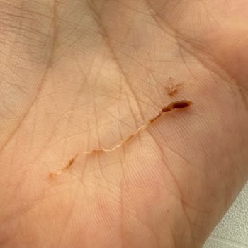 Kavanozun Sonunda Şeffaf İp Parçaları: Gıda Güvenliğine Dair Derin Endişe