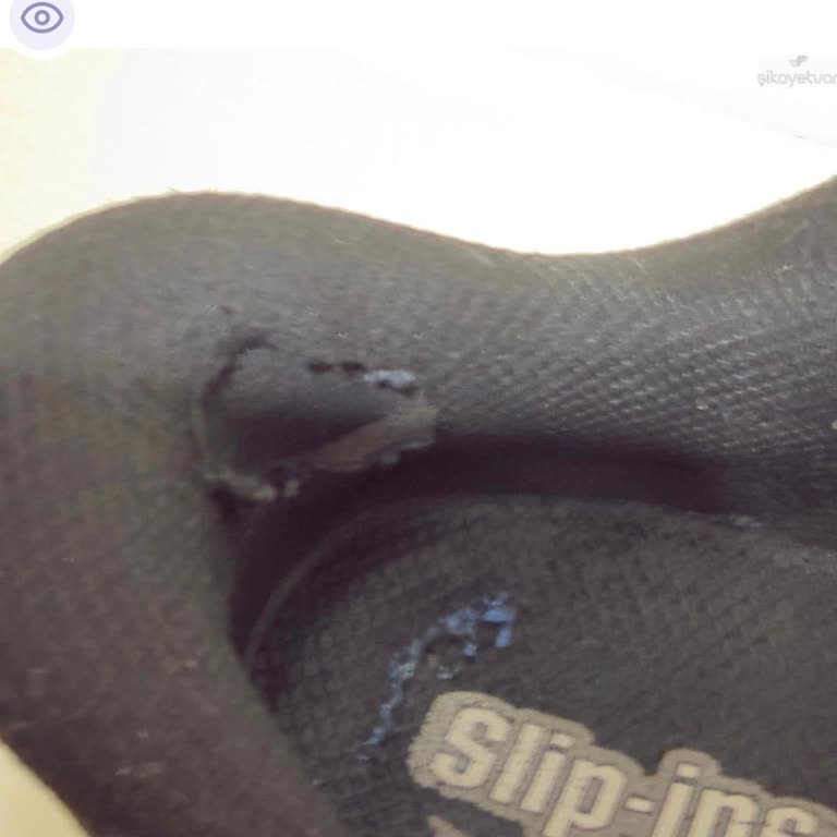 Ayıplı Skechers Ayakkabı Ve Uzun Süreli İade Sürecinde Bilgilendirme Eksikliği