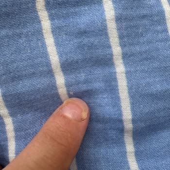 Kusurlu Bebek Takımı Nişan Günü İçin Geç Teslim Ve Çözüm Yok