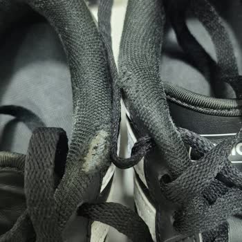 Ayıplı Adidas Ayakkabısının İade Ve Değişim Talebi Reddedildi