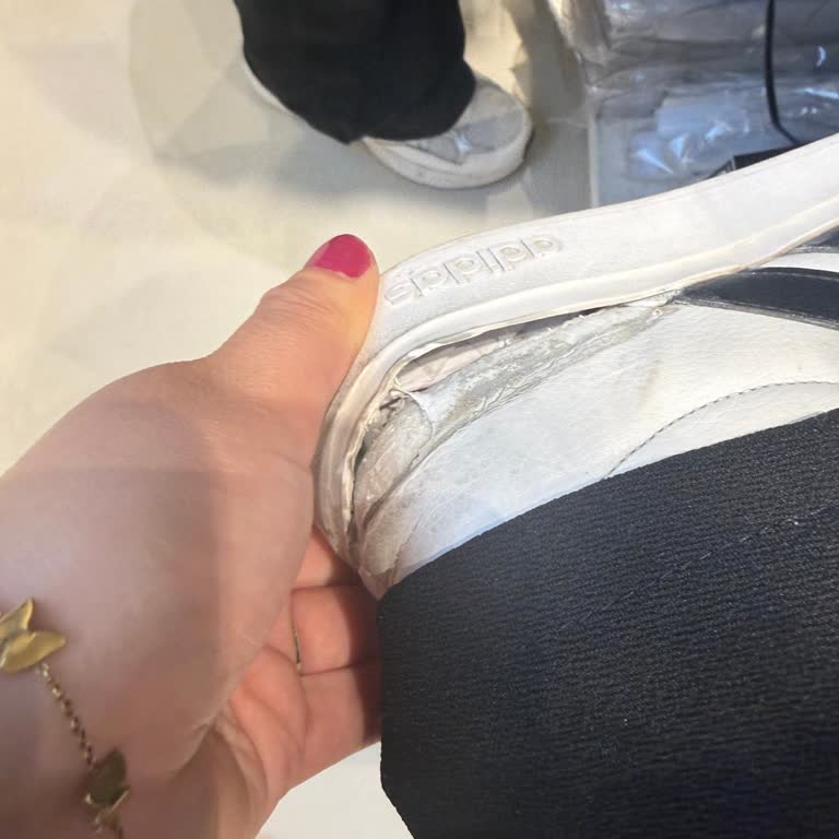 Adidas Ayakkabısının 3 Ayda Açılan Tabanı Ve Fotoğrafla Reddedilen İade Talebi