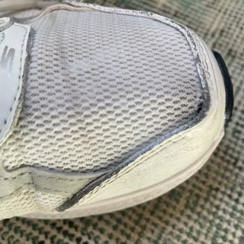 Skechers Ayakkabısında Kısa Sürede Açılma Ve Ücretsiz Değişim Talebi