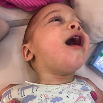 Enterogermina Kids Kullanımında Çocukta Ağır Alerjik Reaksiyon Ve Tazminat Talebi