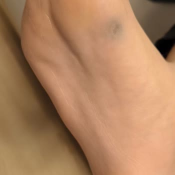Renk Sızdıran Ayakkabıda Kullanıcı Hatası İddiası Ve Sorumsuz Müşteri Hizmetleri