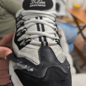 Skechers Ayakkabısının Kısa Sürede Patlaması Ve Mağazanın Değişim Reddetmesi