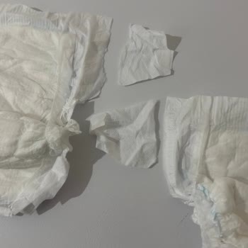Molfix 6 Numaralı Bezlerde Cırt Kopma Sorunu Ve İade Talebi