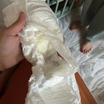 Molfix Bezlerinde Katman Ayrılması Ciddi Sızdırma Ve İade Talebi