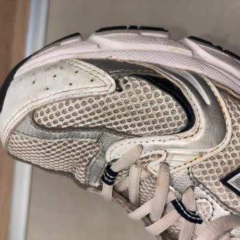 New Balance Ayakkabısında Kısa Sürede Yan Açılma: Üretim Hatası Ve İade Talebi