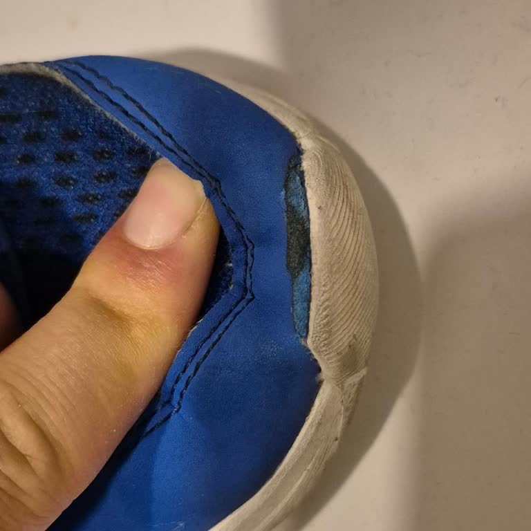 Skechers Çocuk Ayakkabısında Açılan Ön Üretim Hatası Olarak Kabul Edilmedi