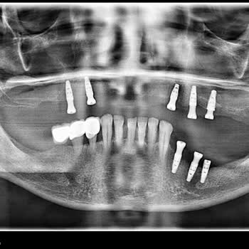 Dentistün Diş Sağlığı Merkezi Hatalı İşlem