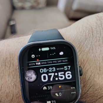 Xiaomi Redmi Watch 5 Şarj Süresi Düşüşü Ve Çözüm Talebi