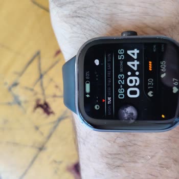 Xiaomi Redmi Watch 5 Şarj Süresi Düşüşü Ve Çözüm Talebi