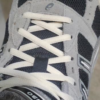 Asics Gel 1130 Ayakkabısının Başparmak Bölgesindeki Yırtılma Ve Çözüm Eksikliği