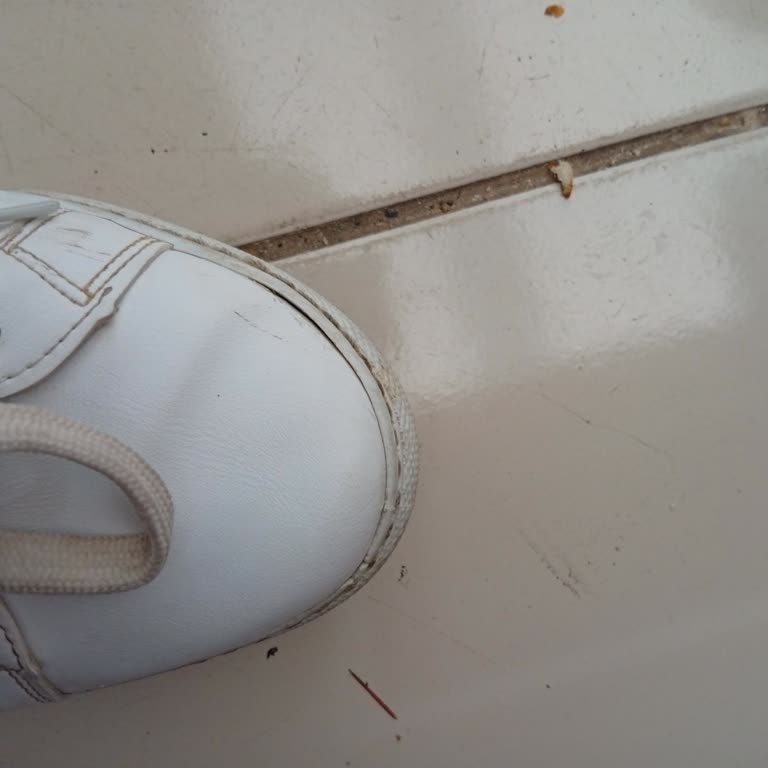 Torex Ayakkabısının 10 Gün Sonra Açılması Ve Kalite Sorunu
